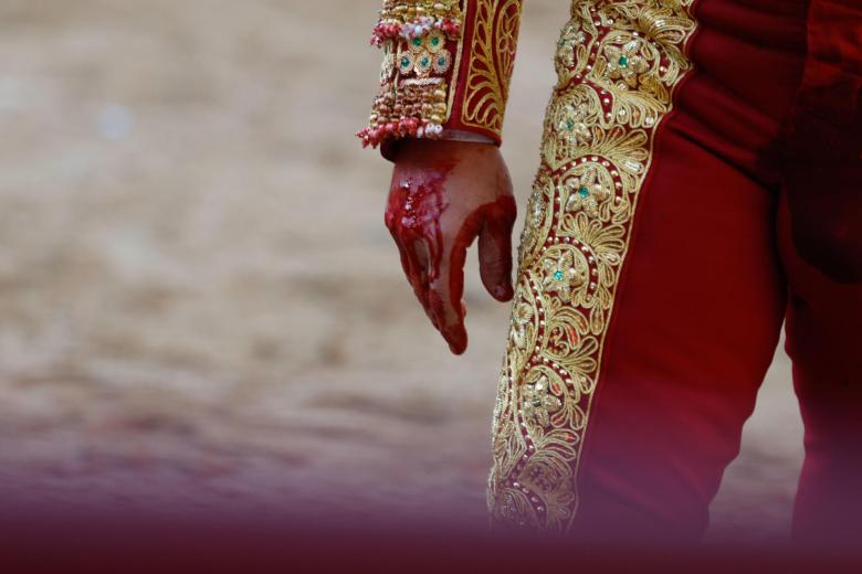 Detalle de la mano ensangrentada de Morante de la Puebla